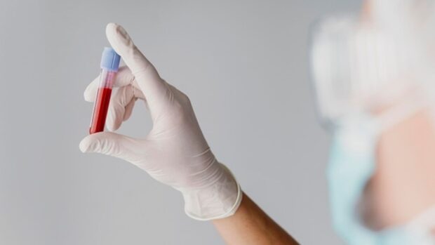 ¿Tienes hierro bajo aunque no tengas anemia? La nueva guía médica cambia el umbral